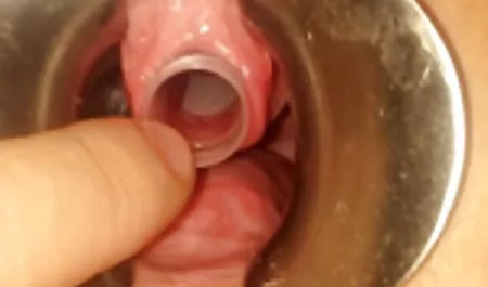 Jungs sexfilm krankenschwester haben Spaß mit Freundinnen